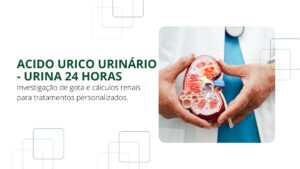 Controle do Metabolismo com Ácido Úrico Urinário – Urina 24 Horas